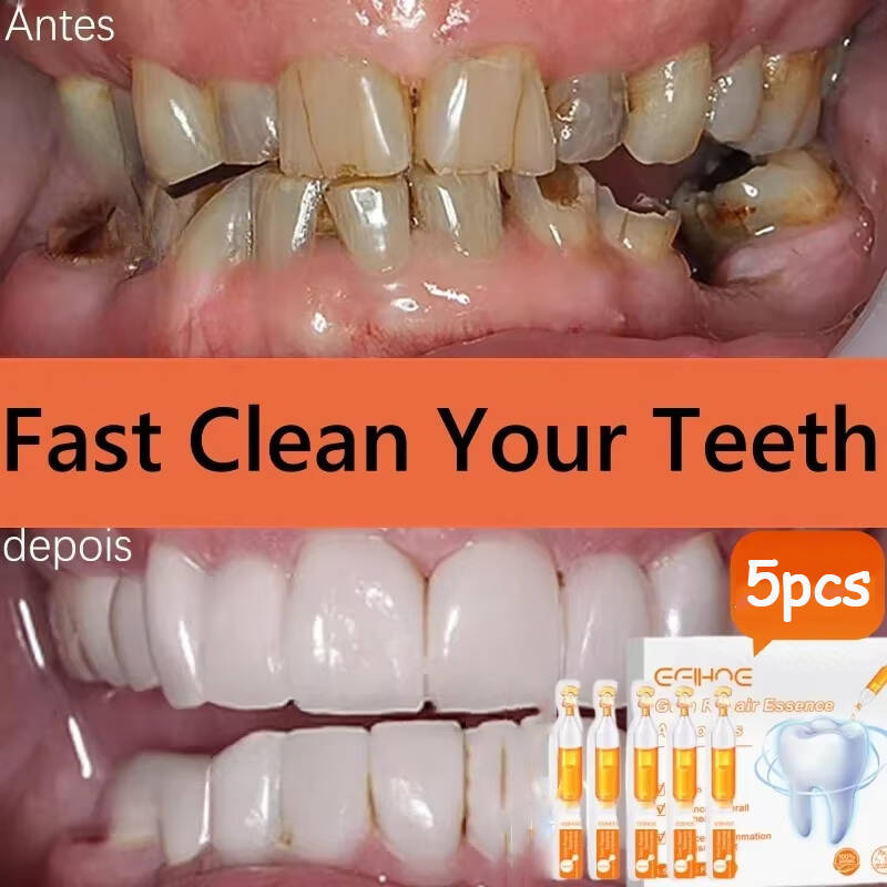 Teeth Whitening With Baking Soda - إصلاح سريع مصل اللثة تخفيف إعادة
