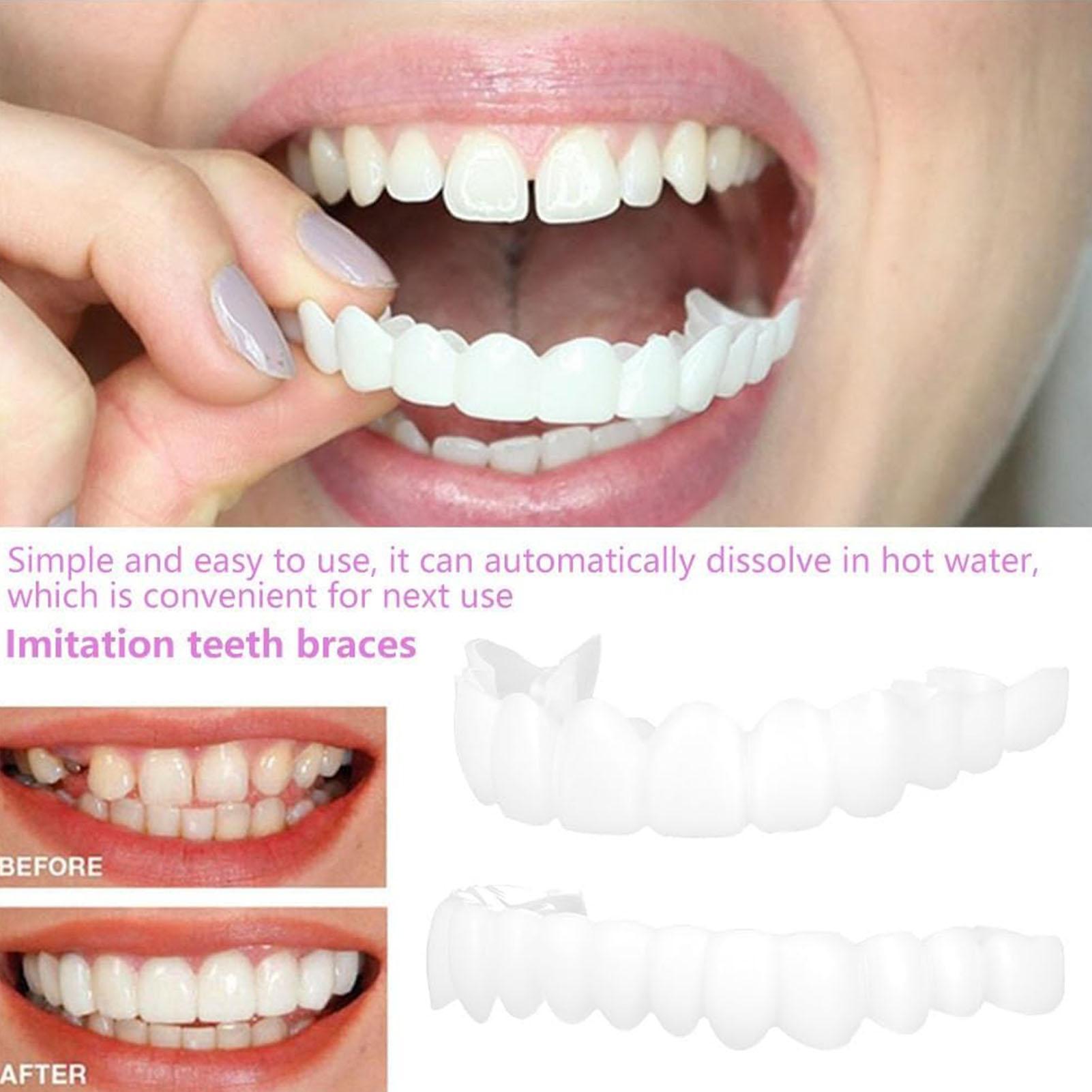 Teeth Whitening Mask - 2 قطعة قشور الأسنان المؤقتة للرجال