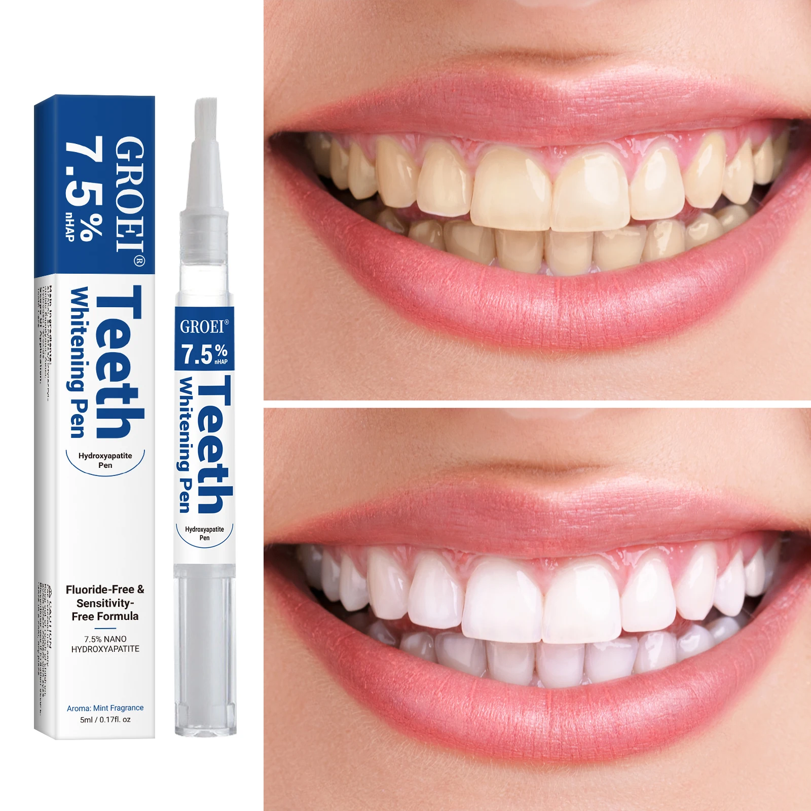 هيدروكسياباتيت تبييض الأسنان ا - مراجعة Teeth Whitening Pens وسعره