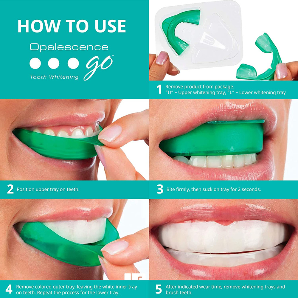 بيروكسيد الهيدروجين لتبييض الأ - مراجعة Teeth Whitening With Trays وسعره