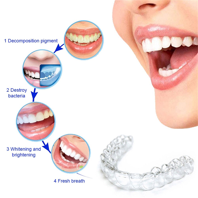 واقي أسنان ليلي من السيليكون م - مراجعة Teeth Whitening With Trays وسعره