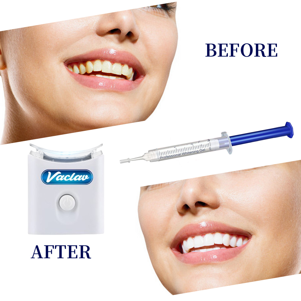 النعناع تبييض الأسنان جل حقنة  - مراجعة Teeth Whitening With Baking Soda وسعره