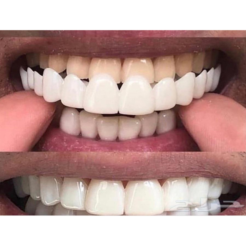 لينة سيليكون جل الأسنان الفم ا - مراجعة Teeth Whitening Moulds وسعره