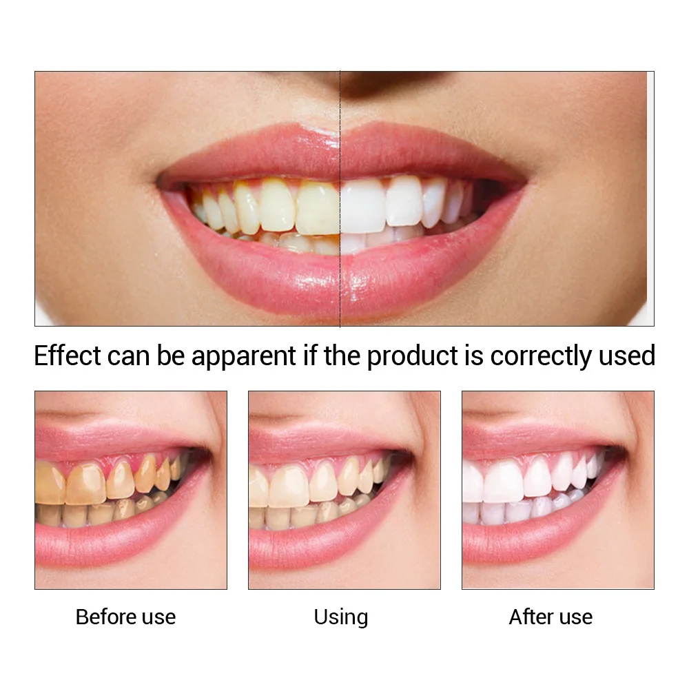 Fteenly تبييض الأسنان جوهر مسح - مراجعة Teeth Whitening Natural وسعره