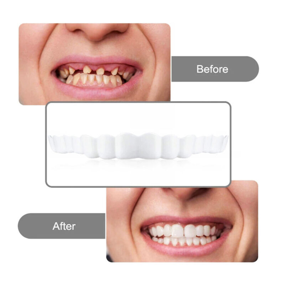 4-6 أزواج من أطقم أسنان الفك ا - مراجعة Teeth Whitening Mask وسعره