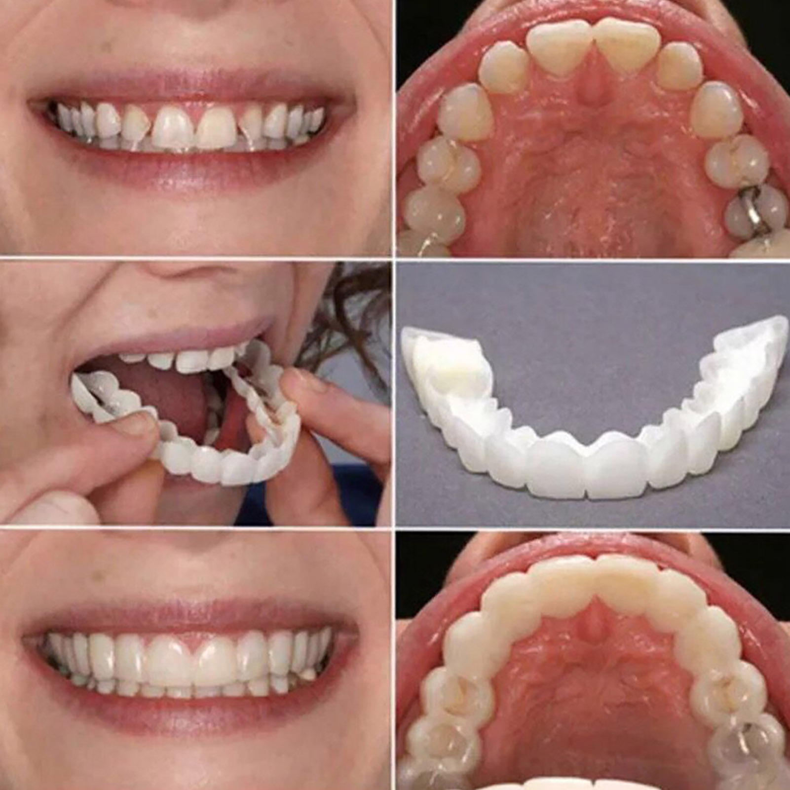 طقم أسنان اصطناعية مؤقتة لتبيي - مراجعة Teeth Whitening Mask وسعره
