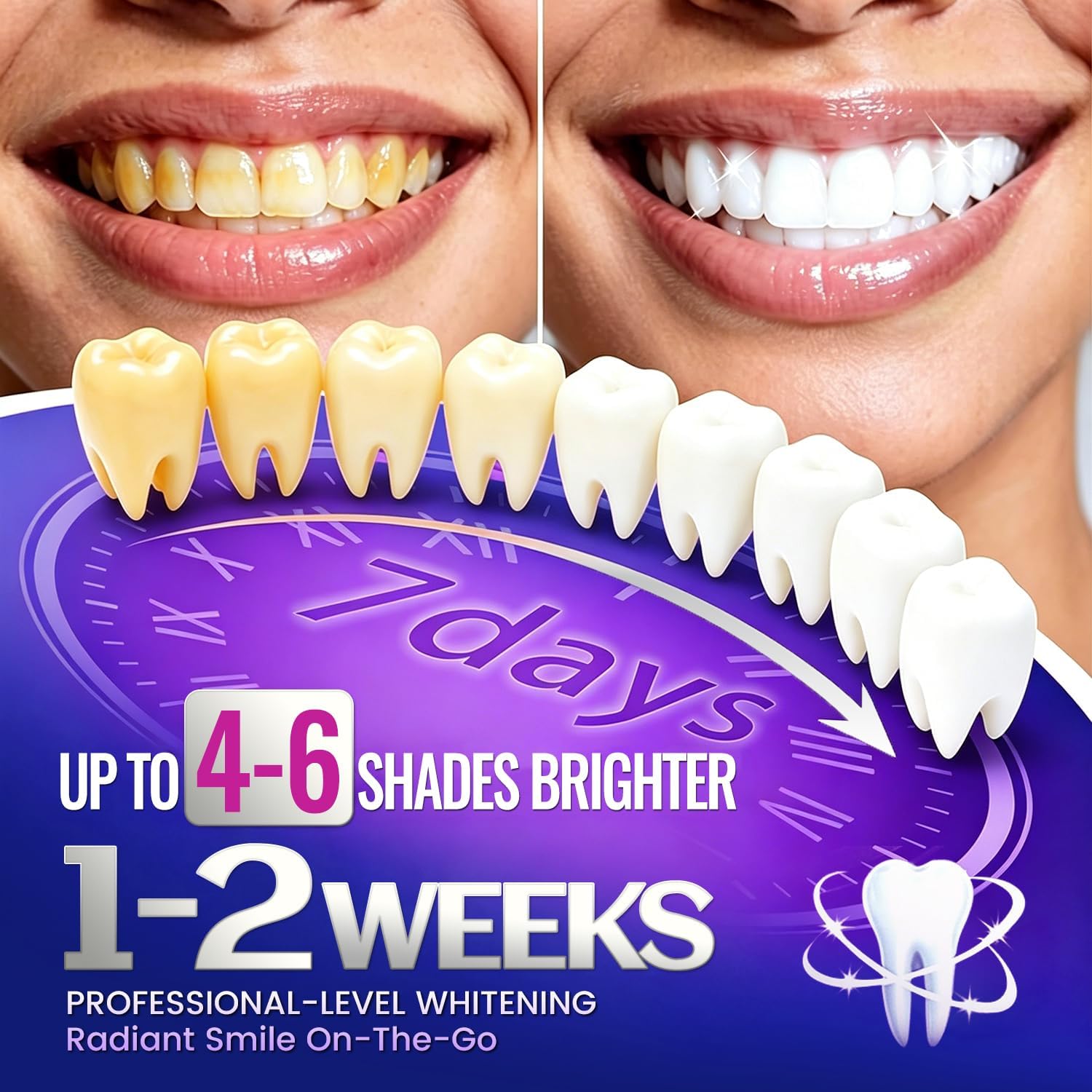 شرائط تبييض الأسنان (1/7 زوج)  - مراجعة Teeth Whitening Retainer وسعره