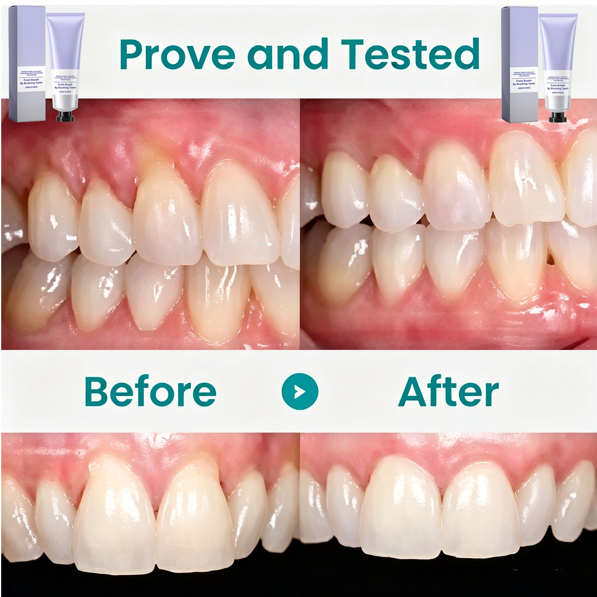 معجون أسنان بثبات الصودا وملح  - مراجعة Teeth Whitening With Baking Soda وسعره