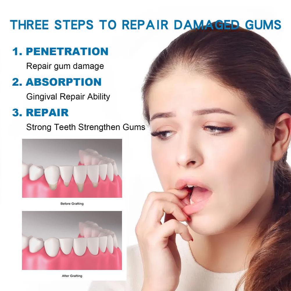 معجون أسنان للعناية بالأسنان،  - مراجعة Teeth Whitening Natural وسعره