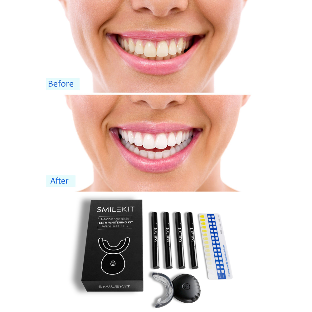 جديد الكهربائية تبييض الأسنان  - مراجعة Teeth Whitening Bleaching Kit وسعره