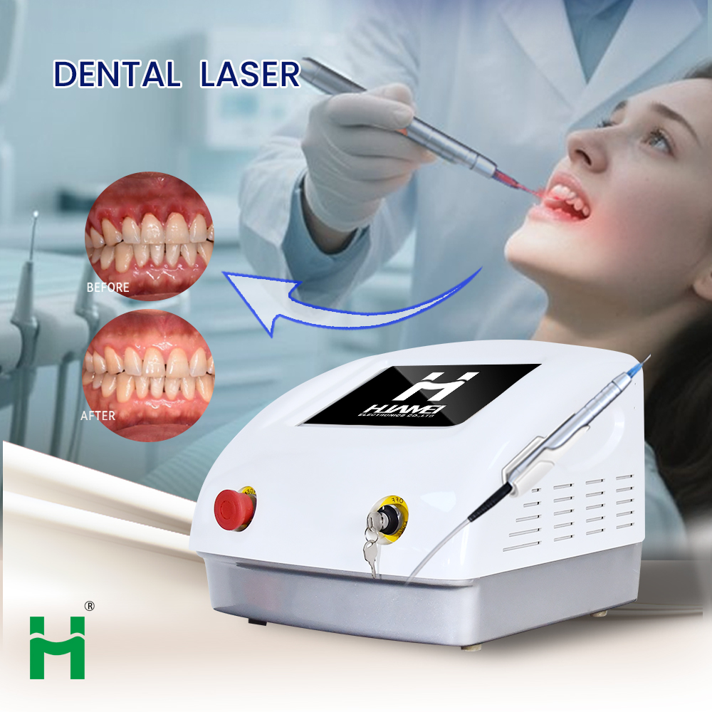 طقم تبييض الأسنان المحمول بتقن - مراجعة Teeth Whitening Bleaching Kit وسعره