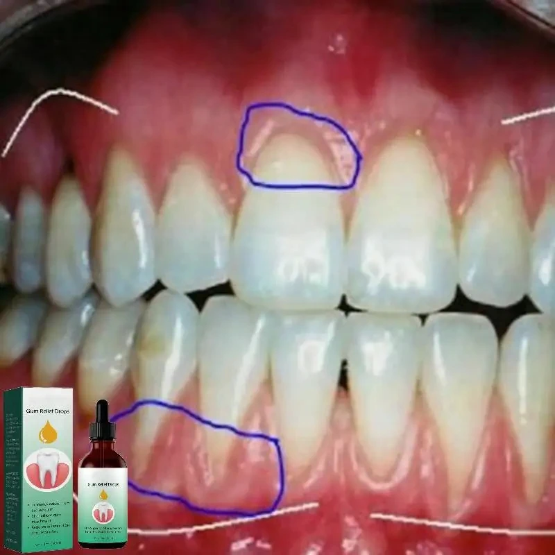 قطرات إصلاح اللثة تخفيف إعادة  - مراجعة Teeth Whitening Paste وسعره