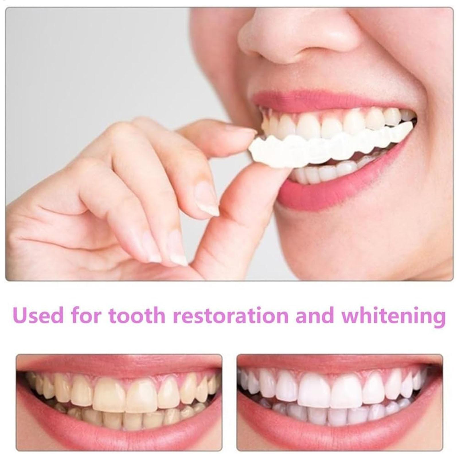 2 قطعة قشور الأسنان المؤقتة لل - مراجعة Teeth Whitening Mask وسعره