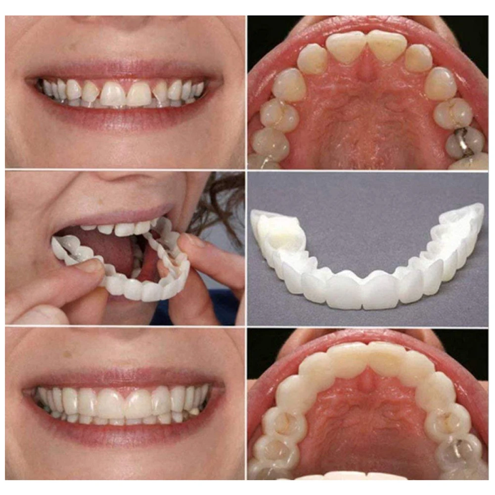 تبييض الأسنان للرجال والنساء ، - مراجعة Teeth Whitening Mask وسعره